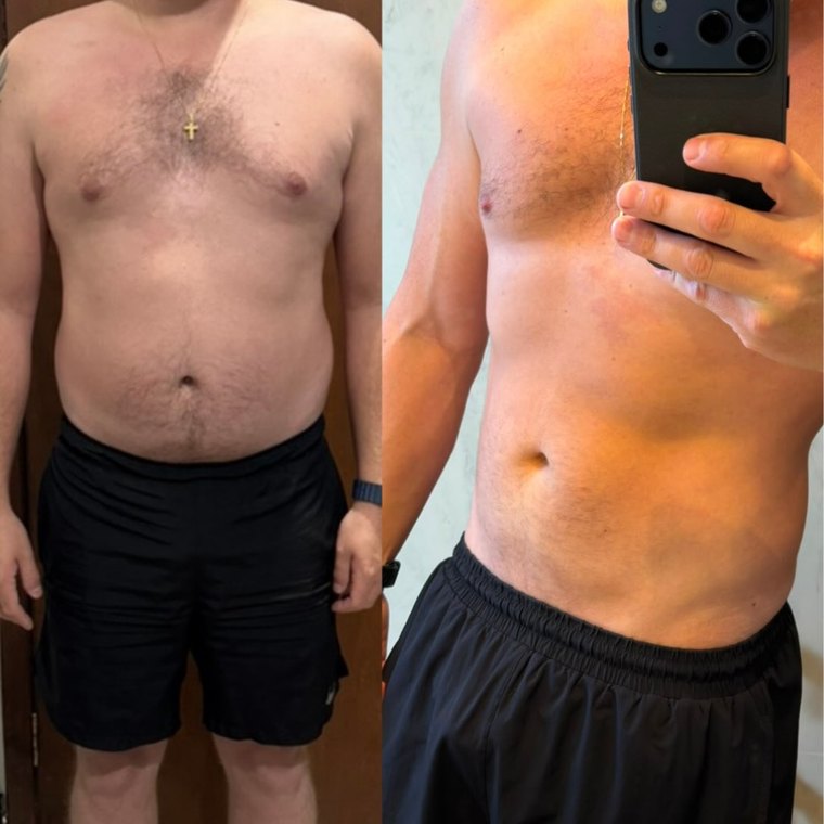 O antes e depois do próprio Renan